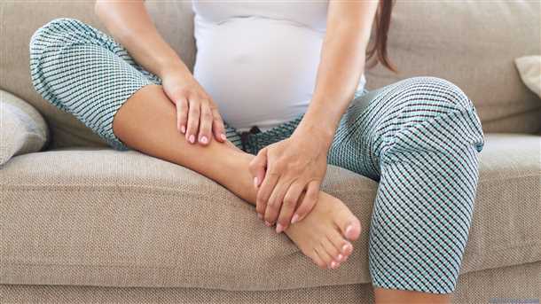 10 способов избавиться от отеков при беременности