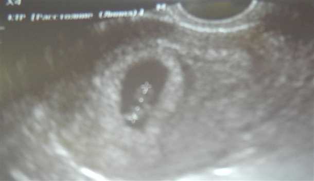 2 неделе беременности от зачатия