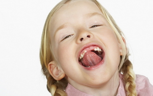 Врожденная особенность – короткая уздечка языка у детей