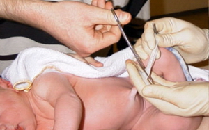 Пуповина у новорожденного кровоточит видео