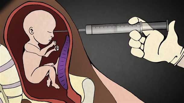 Аборты в день обращения