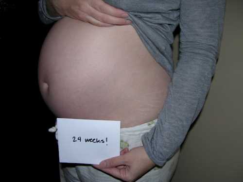 Беременность 24 недели