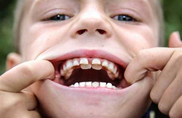 Дети и их зубы