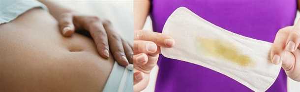 Изменения выделений во время беременности: зуд, неприятный запах