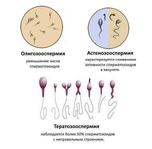 Как увеличить активность сперматозоидов