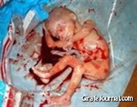 Абортированные дети фото 12