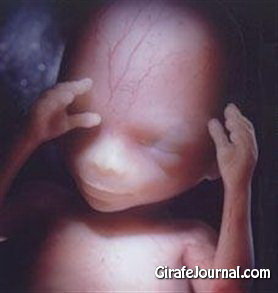 Абортированные дети фото 6