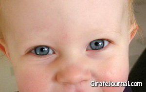 Белый налет на миндалинах у ребенка фото
