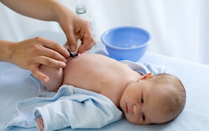Уход и обработка пупочной ранки, а также омфалит у новорожденных детей
