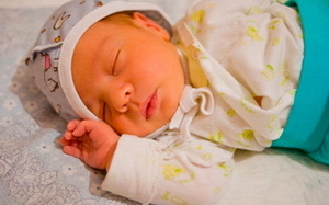 Высокий билирубин у новорожденных фото