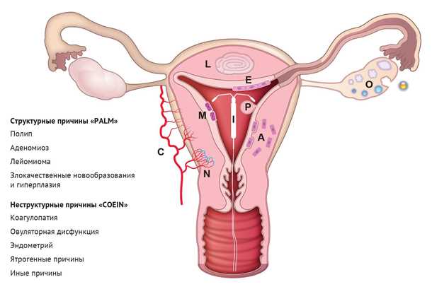 Беременность после эндометриоза