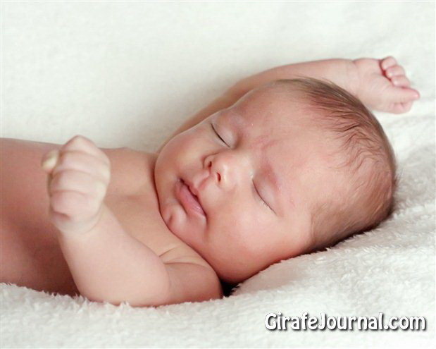 Последствия гемолитической болезни новорожденных фото