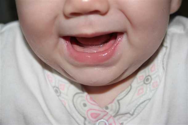 Как распознать прорезывание зубов у детей