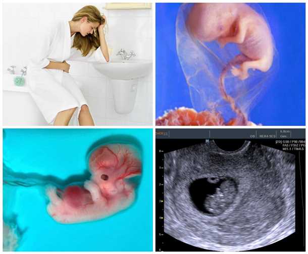 Как выглядит эмбрион в 8 недель беременности