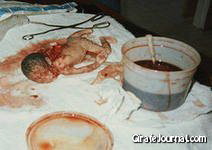 Последствия аборта фото