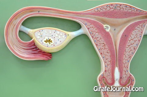 Эндометриоз матки и лечение народными средствами